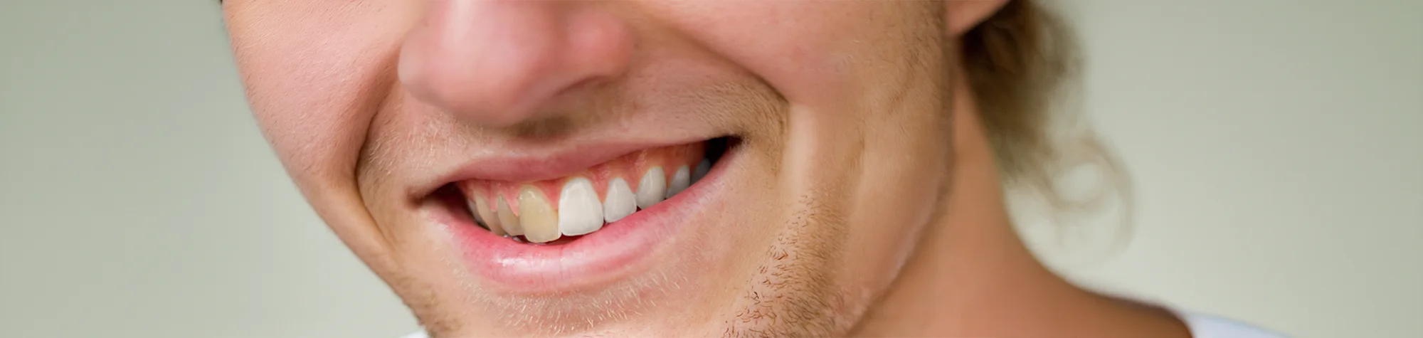 A wide panoramic banner showing a before and after comparison of a professional smile retouch with natural teeth whitening and brightening in Photoshop.