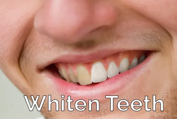 Photoshop tutorial thumbnail featuring the text "Teeth Whitening" over a close-up of a bright, white smile on a dark background.
