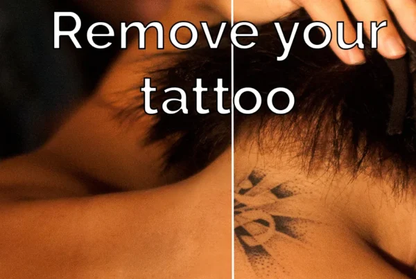 Photoshop tutorial thumbnail featuring the text "Tattoo Removal" over a split-screen image showing a partial tattoo removal on a person's arm.