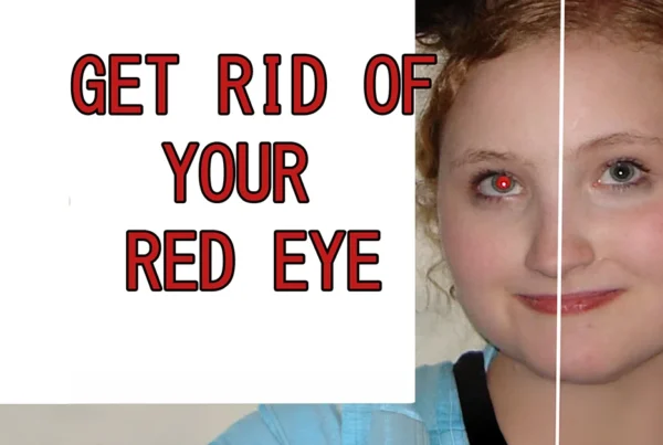 Photoshop tutorial thumbnail featuring the text "Red Eye Removal" over a close-up of a human eye being edited from red to a natural dark color.